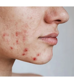 Honnan származhatnak a rejtélyes kiütések?