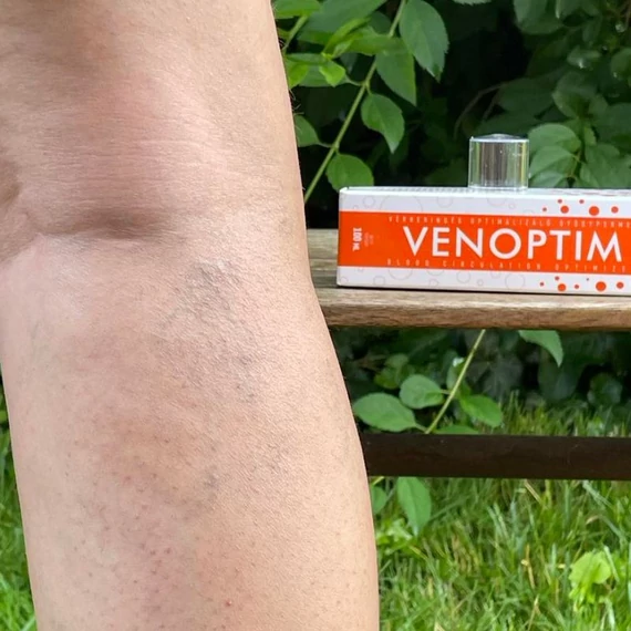 venoptim_visszer_uj maradjegyensulyban